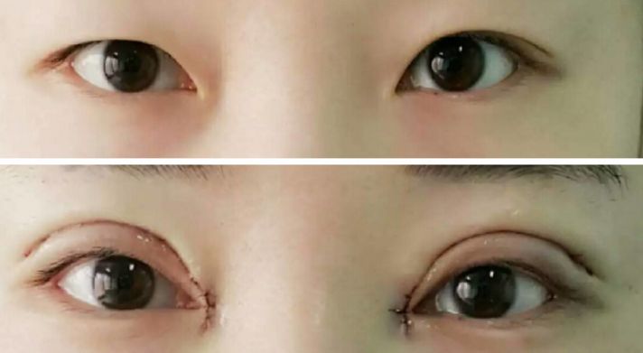 貴陽哪家醫(yī)院熱瑪吉效果好，值得推薦？