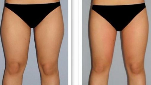 杭州疤痕醫(yī)院排名哪家好？揭秘杭州頂級疤痕醫(yī)院榜單！