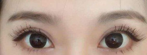 西安哪家醫(yī)院的激光祛痘項(xiàng)目質(zhì)量好？