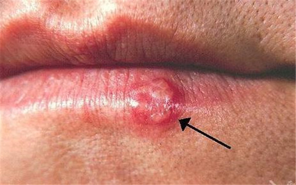 2023青島鼻小柱延長整形術(shù)醫(yī)生排名榜十強(張浩、季禾子、馬昕不一樣的擅長風(fēng)格體驗也不同)