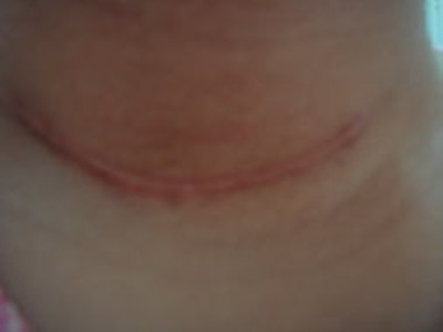 2023徐州玻尿酸注射法令紋醫(yī)生前10強(qiáng)口碑榜(俞曉江、程洋、劉迎迎靠譜醫(yī)院，安心選！)