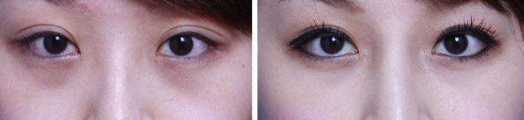 鄭州整容醫(yī)院排名，鄭州做整容找哪家醫(yī)院好