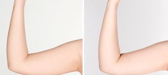 宿州雙眼皮醫(yī)院哪家好？揭秘宿州地區(qū)專業(yè)雙眼皮整形醫(yī)院