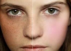 宿州疤痕修復(fù)醫(yī)院哪家好？幫你選擇最適合的宿州疤痕治療?？漆t(yī)院