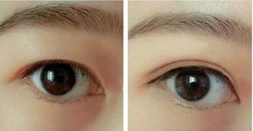 合肥熱瑪吉哪家醫(yī)院好？優(yōu)質(zhì)服務(wù)與專業(yè)技術(shù)讓您擁有完美體驗。