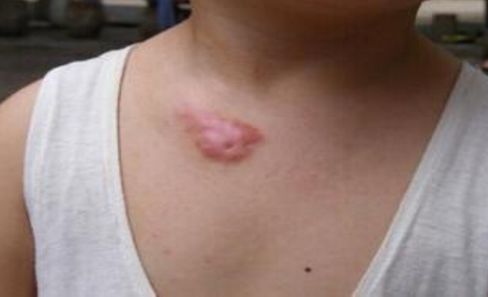 鄭州做鼻子修復(fù)哪家好？權(quán)威排名榜單解析！