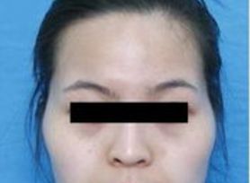 成都治療臉上痘痘哪家醫(yī)院好？專家推薦的成都治痘好醫(yī)院大揭秘！