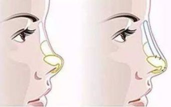 河南中醫(yī)藥大學(xué)第一附屬醫(yī)院整形科技術(shù)與醫(yī)生表現(xiàn)口碑如何？