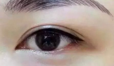 青海大學(xué)附屬醫(yī)院醫(yī)療整形美容科是否專業(yè)可靠？優(yōu)勢有哪些？