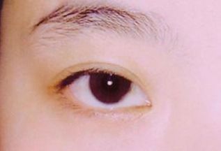 西安看胎記醫(yī)院哪家好？選擇胎記?？漆t(yī)院，專業(yè)技術(shù)得到用戶好評！