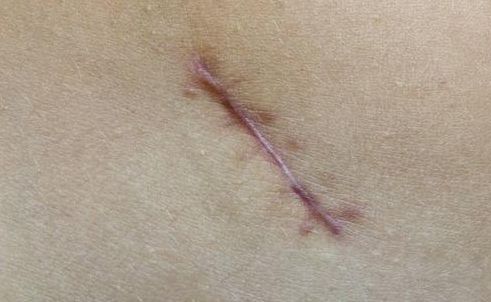 重慶整形技術，哪家醫(yī)院好？探尋重慶整形技術最佳醫(yī)院有哪些