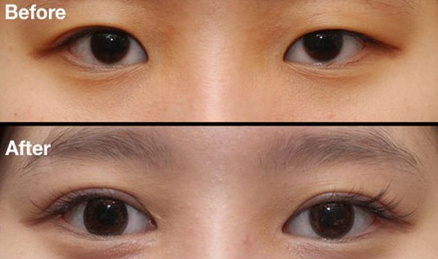 昆明刀疤修復(fù)哪家醫(yī)院好？挑選昆明專業(yè)刀疤修復(fù)醫(yī)院的技巧與要點(diǎn)