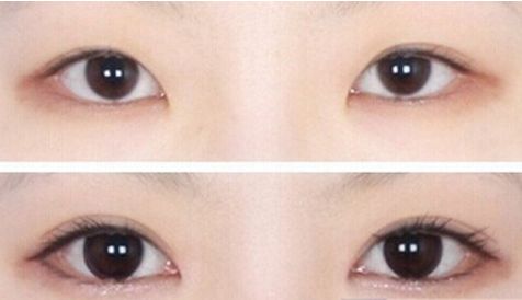 濟(jì)南哪家醫(yī)院的豐胸手術(shù)效果最好？