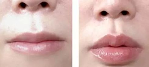 2023南寧乳房縮小醫(yī)生口碑10強(李科、唐超、龔筱嵐專家呼聲很高)