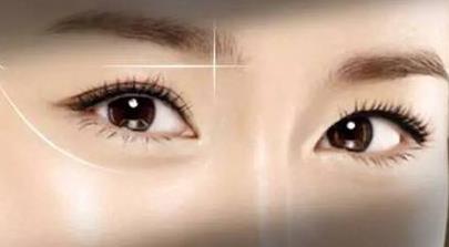 2023南京小切口去除印第安紋專家口碑榜前10強(qiáng)(王珣、汪樹杰、劉明星TOP榜實(shí)力全城俱佳)