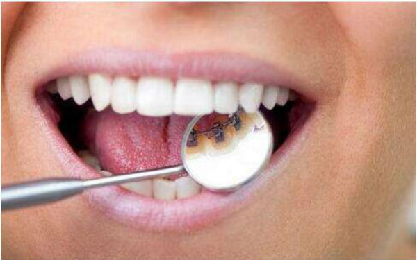 2023長沙下巴后縮正畸醫(yī)生TOP10強口碑排行(寧勝、嚴(yán)友才、黃新凡評價一致贊美)