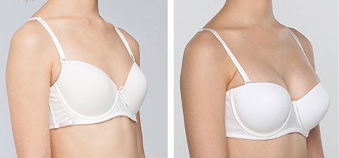 2023大連SVF自體脂肪移植口碑排行前10醫(yī)生(劉延偉、趙鳳霞、趙穆欣市民評(píng)價(jià)好正規(guī)不坑)