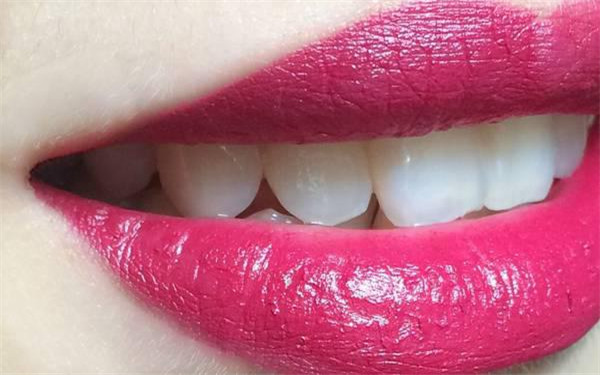 2023北京整顴骨醫(yī)生口碑榜TOP10(李或馨、王新燦、李文海入選小眾精品醫(yī)美)