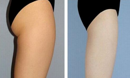 上海改臉型整形哪家醫(yī)院好？專家推薦悅美人整形醫(yī)院！