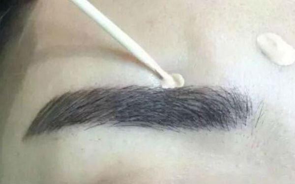 徐威強顎下角整形術(shù)：讓您輕松擁有自然平滑線條