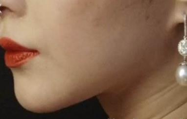 2023長春無痕4D隆鼻專家前十強(qiáng)排名(莊璐、趙貴慶、魏軍劍個(gè)個(gè)特色鮮明)