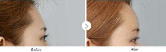 河南有哪家專業(yè)的小腿抽脂醫(yī)院值得推薦？