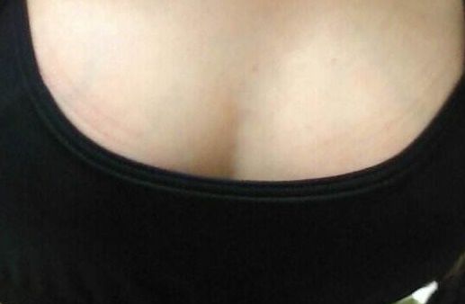 青島哪家醫(yī)院雙眼皮手術(shù)效果好，術(shù)后無后顧之憂