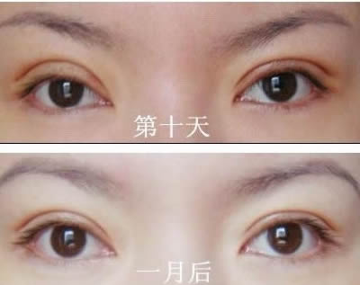 2023洛陽額頭打除皺針在榜單前十位醫(yī)生(劉戰(zhàn)輝、黃浩浩、周先華手法嫻熟自然)