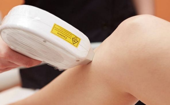 重慶水剝離技術(shù)哪家醫(yī)院好？一探醫(yī)院選擇先關(guān)指南