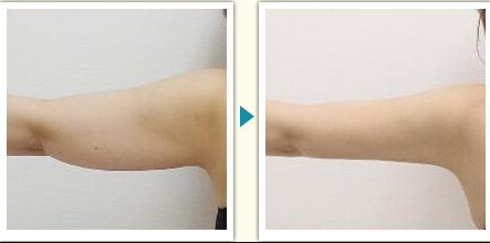 衢州市整容醫(yī)院哪家好？了解衢州市整容醫(yī)院的專業(yè)團(tuán)隊和先進(jìn)設(shè)備