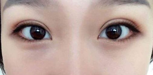 永州地區(qū)哪家正規(guī)整形醫(yī)院好？