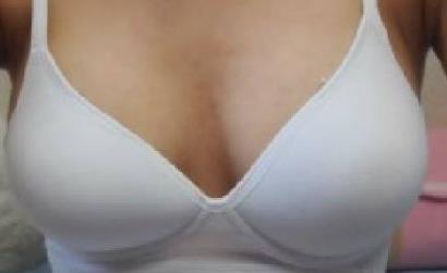 2023成都骨膠原填充下巴權威專家評價前十名(李媚、馮牧夷、葛振國綜合實力靠前！)