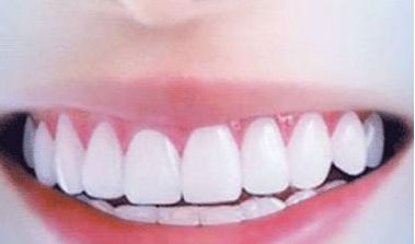 呢？衢州美萊整形美容醫(yī)院簡介、技術(shù)優(yōu)勢、口碑在線查看！