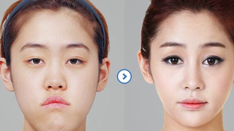 北京大學(xué)國(guó)際醫(yī)院整形外科醫(yī)生口碑如何？整形費(fèi)用合理嗎？