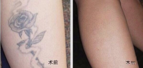 不二選擇！上海鼻修復(fù)專家徐永豐、劉仁輝搶占熱門名單成功！個人實力攀升不可阻擋！