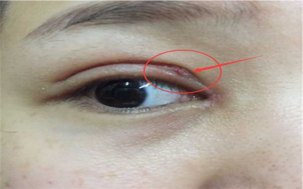 蘇州隆胸哪家醫(yī)院好？專業(yè)醫(yī)師為您分析