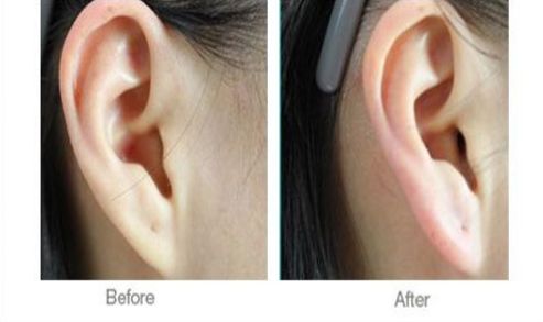 如何選擇西安哪家醫(yī)院術后康復好的機構？