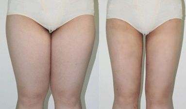 西安北郊美容整形哪家好？揭秘西安北郊最受歡迎的美容整形機(jī)構(gòu)排名