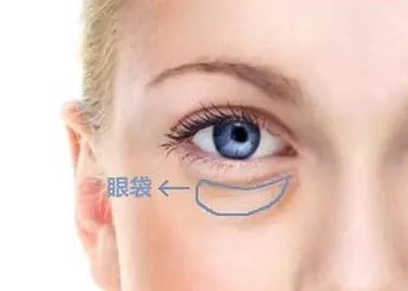 蘇州哪家醫(yī)院治療黃褐斑效果好？