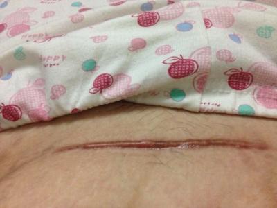 2023廈門胳膊吸脂專家排行榜前10(李強、劉培林、閆保程熱門醫(yī)生簡介發(fā)布)