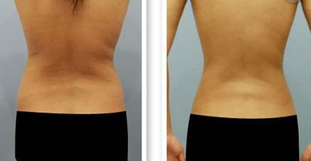 【2023最新】蘭州哪家醫(yī)院治療祛紅血絲效果好？