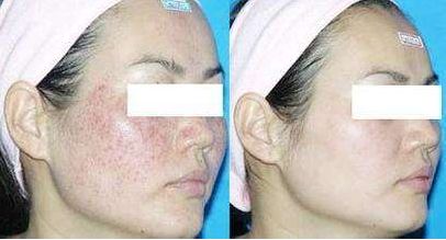 揭陽市哪家醫(yī)院的美容整形技術(shù)最好？