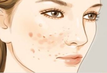 杭州雙眼皮哪家技術(shù)好？了解杭州雙眼皮開眼角好的醫(yī)院