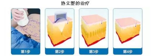 上海臉部祛斑哪家醫(yī)院好？揭秘上海市最受歡迎臉部祛斑醫(yī)院排行榜