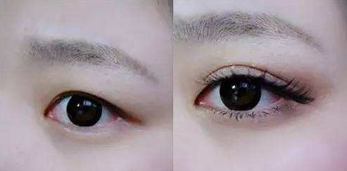 天津祛痘醫(yī)院哪家好？解決痘痘問題，選擇最佳去痘醫(yī)院