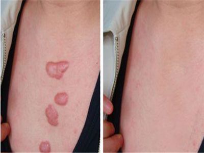 云南哪家整形醫(yī)院好？找個專業(yè)的才放心！