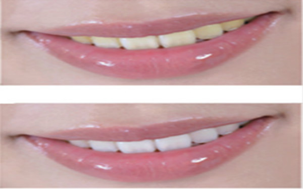 2023鄭州隔空溶脂瘦手臂正規(guī)醫(yī)生評(píng)價(jià)前10強(qiáng)(蔣秀娟、牛永敢、楊勝發(fā)個(gè)人簡介、技術(shù)優(yōu)勢分析！)