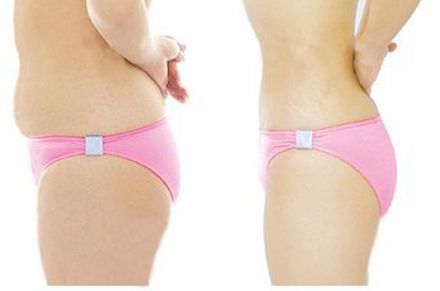 選擇衡陽哪家好的眼袋醫(yī)院？