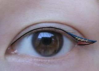 2023昆明隆胸整形哪家醫(yī)院好？專家推薦與真實(shí)案例一覽