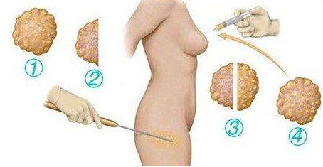 上海市排名靠前的專業(yè)祛疤痕醫(yī)院有哪些？